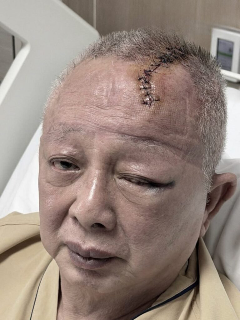 สนธิ ลิ้มทองกุล